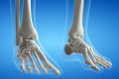 Orthopädie Fuß | Klinik für Orthopädie Siegen